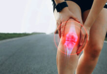 Managing Runner’s Knee