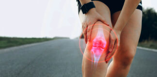 Managing Runner’s Knee